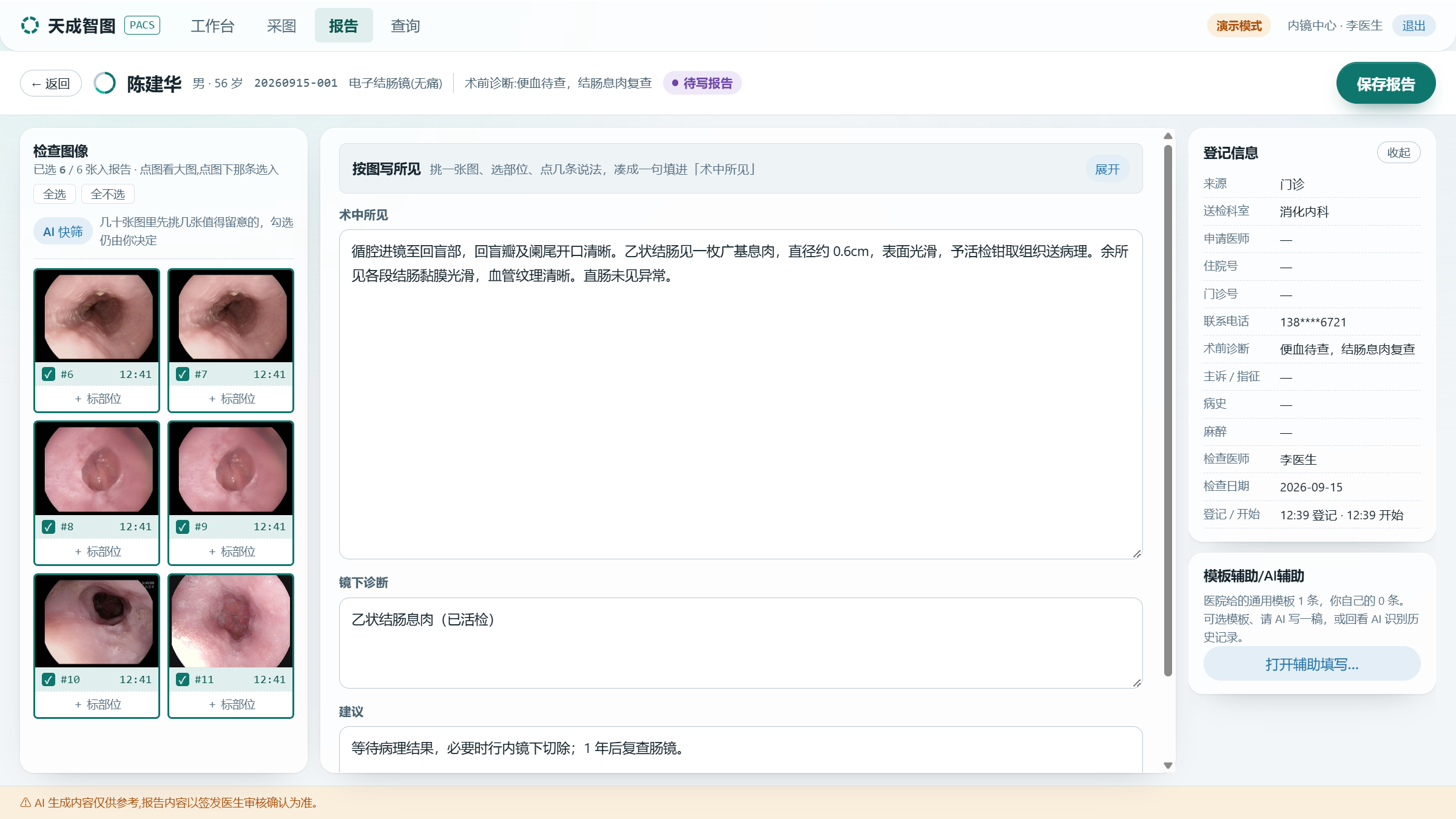 天成内镜工作台报告编写界面截图